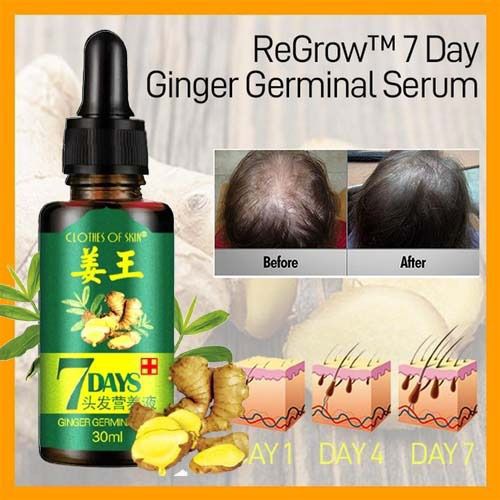 7 Day Ginger Germinal Oil – Hair Growth Essence Serum for Fast Natural Hair Regrowth & Hair Loss Treatment