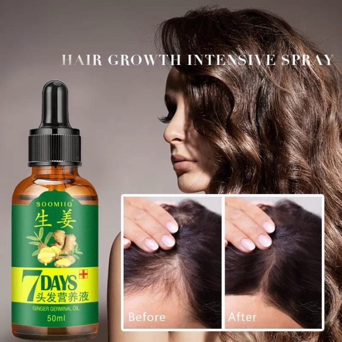 7 Day Ginger Germinal Oil – Hair Growth Essence Serum for Fast Natural Hair Regrowth & Hair Loss Treatment